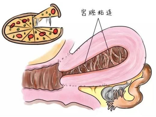 代怀小孩哪里好【代怀小孩哪里好？选择优质代怀机构需谨慎】