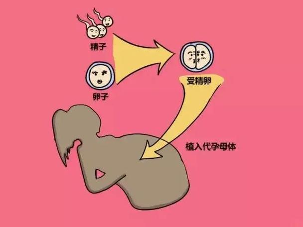 代生孩子有吗_代生孩子有吗?选择代孕的利与弊